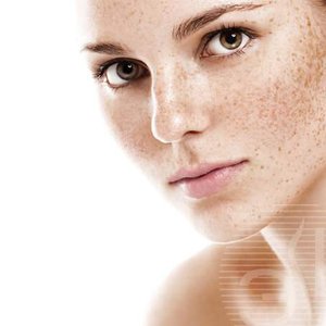 Лечение пигментации кожи лица